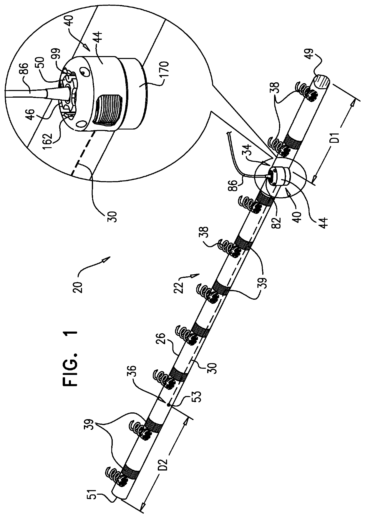 Closed band for percutaneous annuloplasty