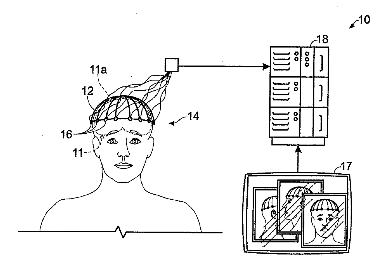 Method for locating tracts of electrical brain activity