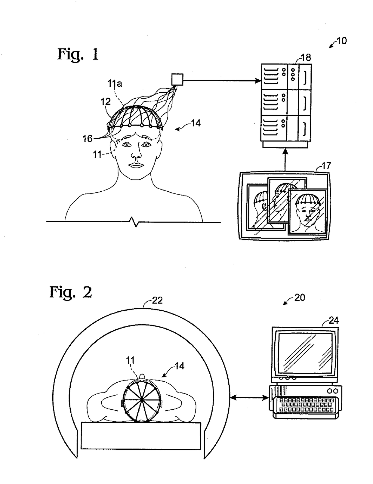 Method for locating tracts of electrical brain activity