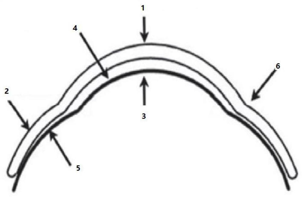 Sclera lens having open window and concave bag