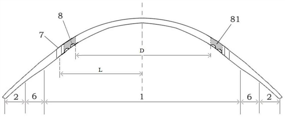 Sclera lens having open window and concave bag