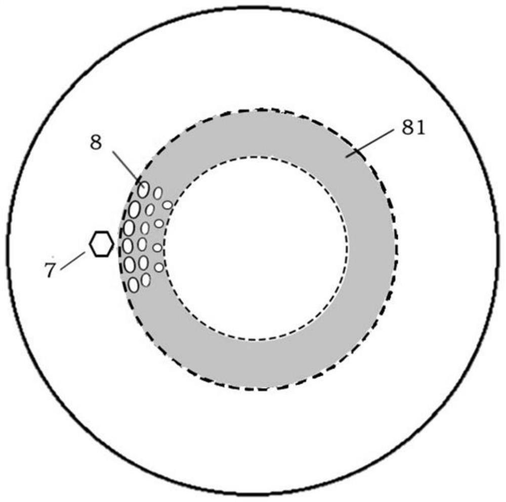 Sclera lens having open window and concave bag