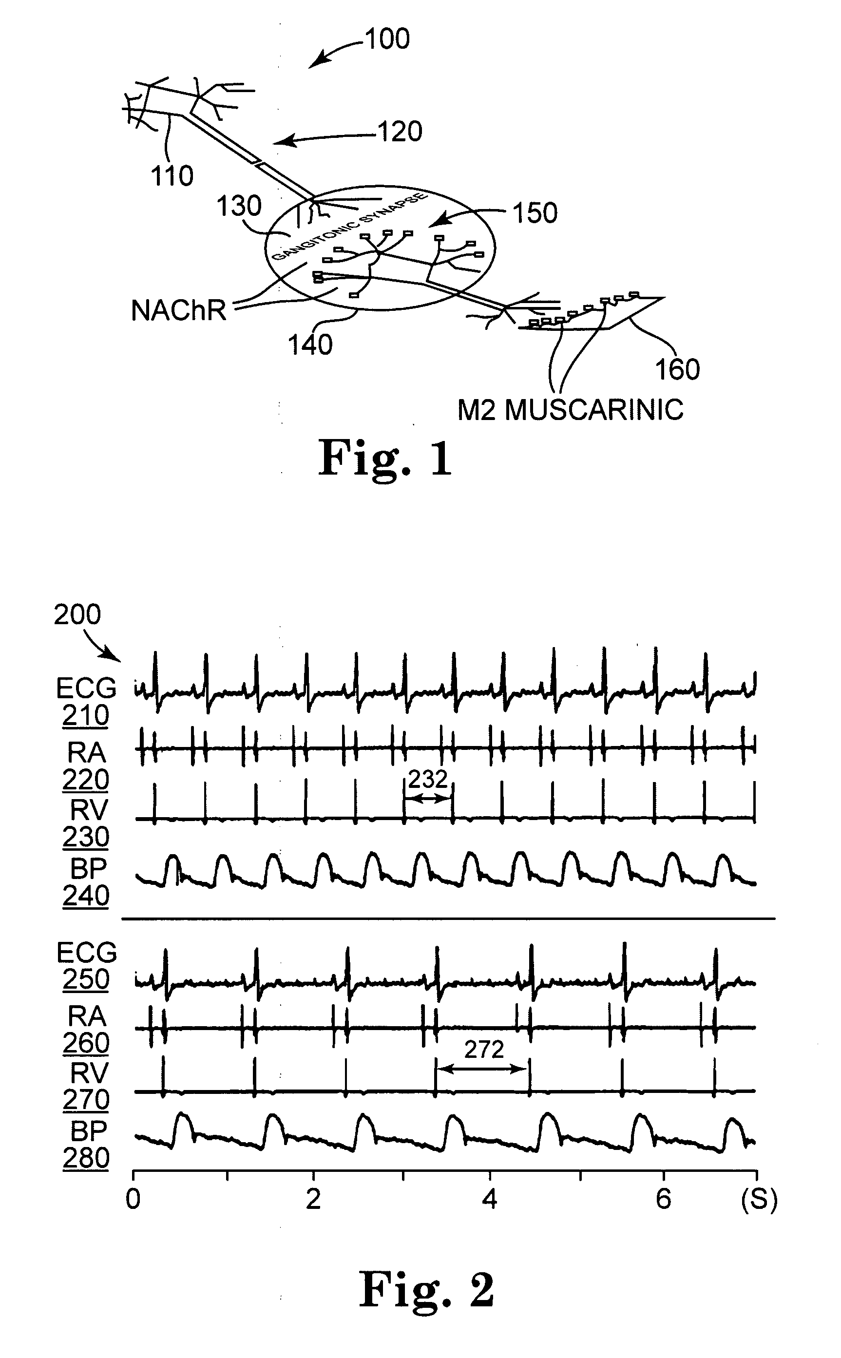 Post-operative control of cardiac arrhythmia by modification of neuronal signaling through fat pads of the heart