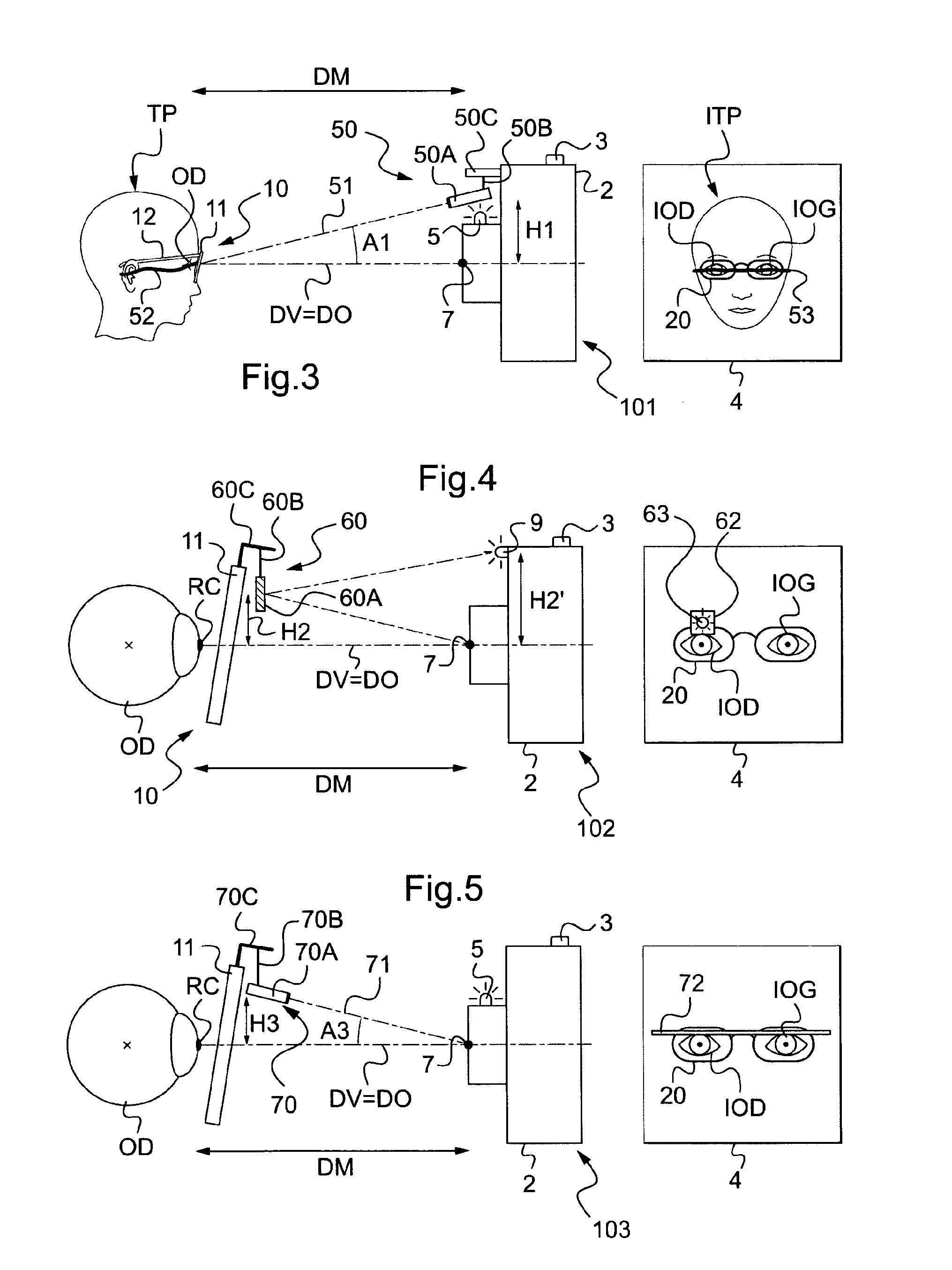 Method of measuring at least one geometrico-physionomic parameter for positioning a frame of vision-correcting eyeglasses on the face of a wearer