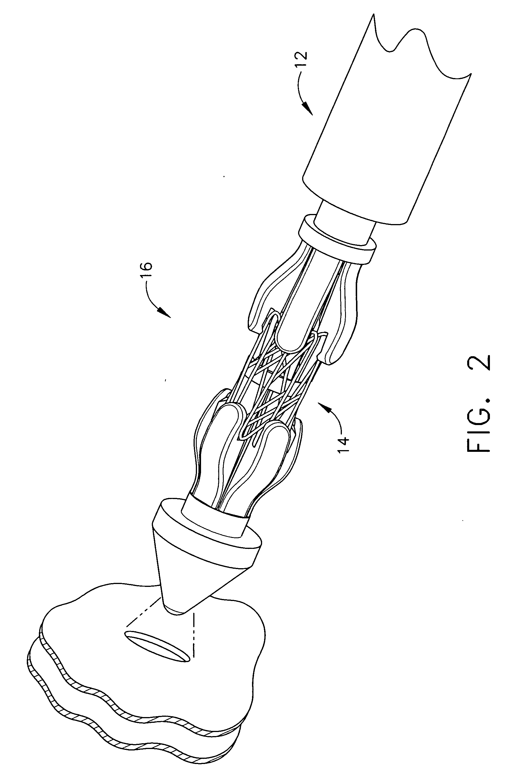 Flexible endoscopic anastomotic ring applier device