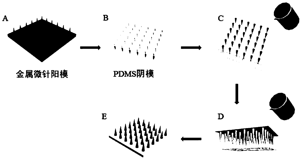 Polypeptide nanoparticle for treating diabetes mellitus, polypeptide nanoparticle microneedle and preparation method of polypeptide nanoparticle microneedle