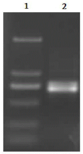 Iba1 and LAG-3 dual-gene co-expression recombinant adenovirus vector and preparation method and application thereof