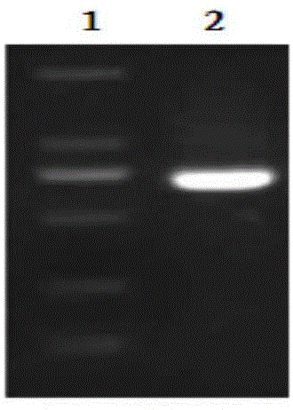 Iba1 and LAG-3 dual-gene co-expression recombinant adenovirus vector and preparation method and application thereof