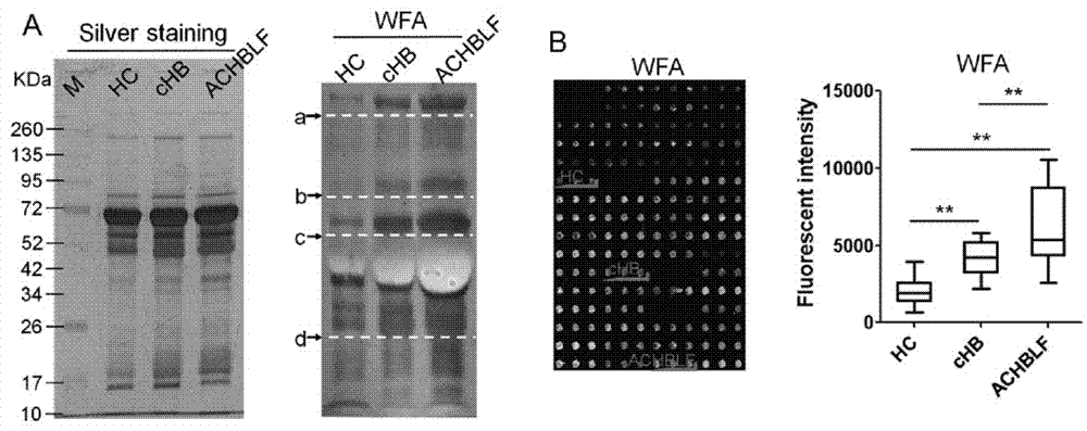 A lectin chip and kit for detecting sugar chain markers based on saliva and co-based on proteins in saliva and serum and its application