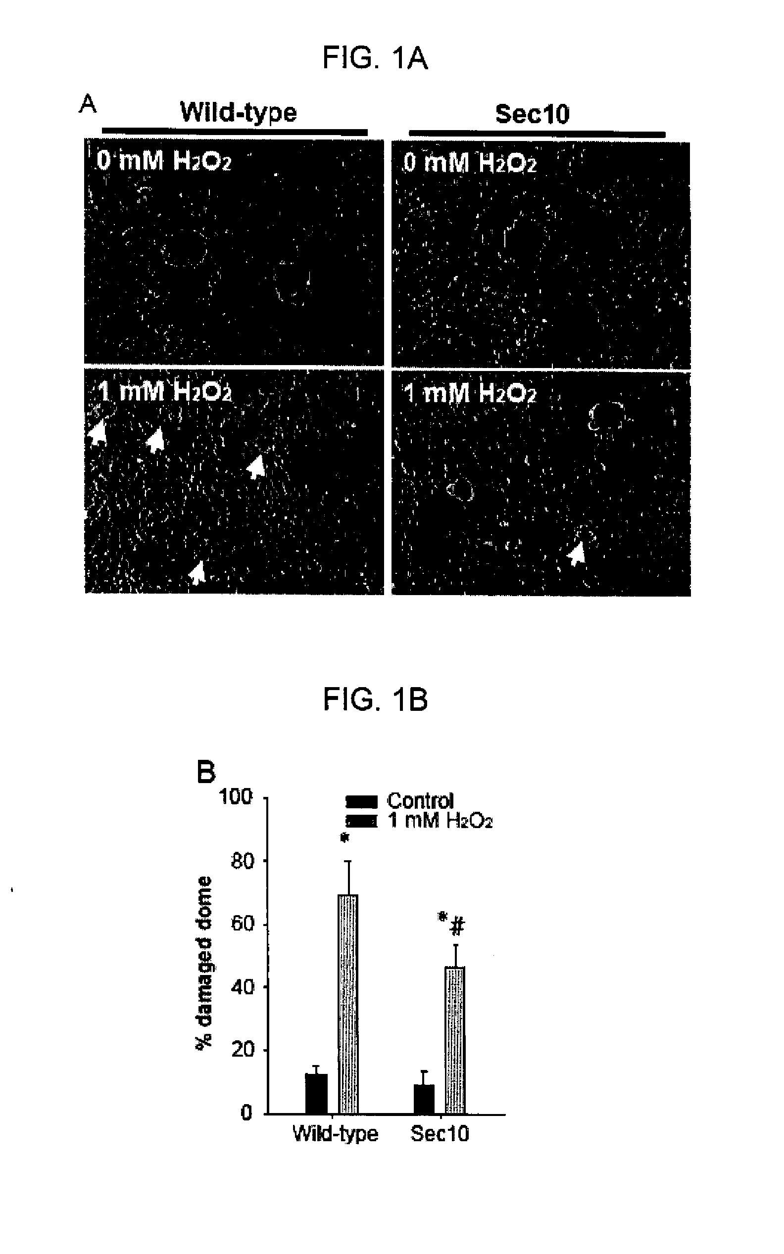 AAV Vectors Expressing SEC10 for Treating Kidney Damage