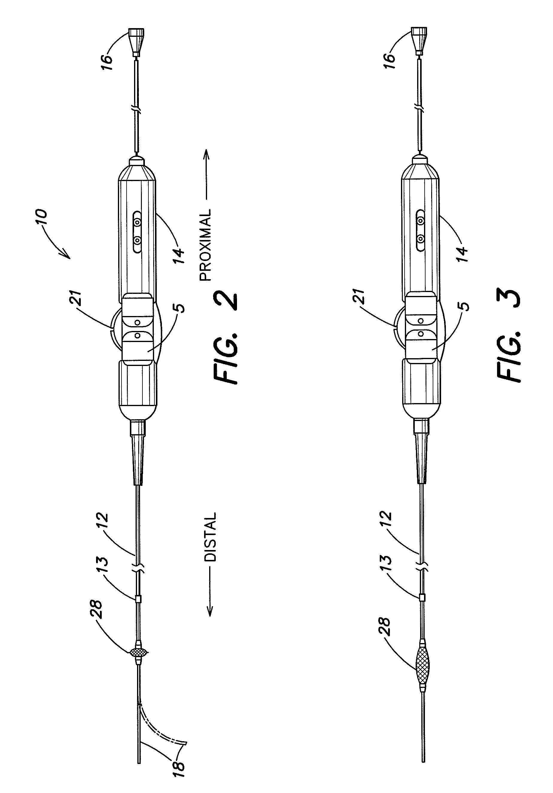 Braided mesh catheter