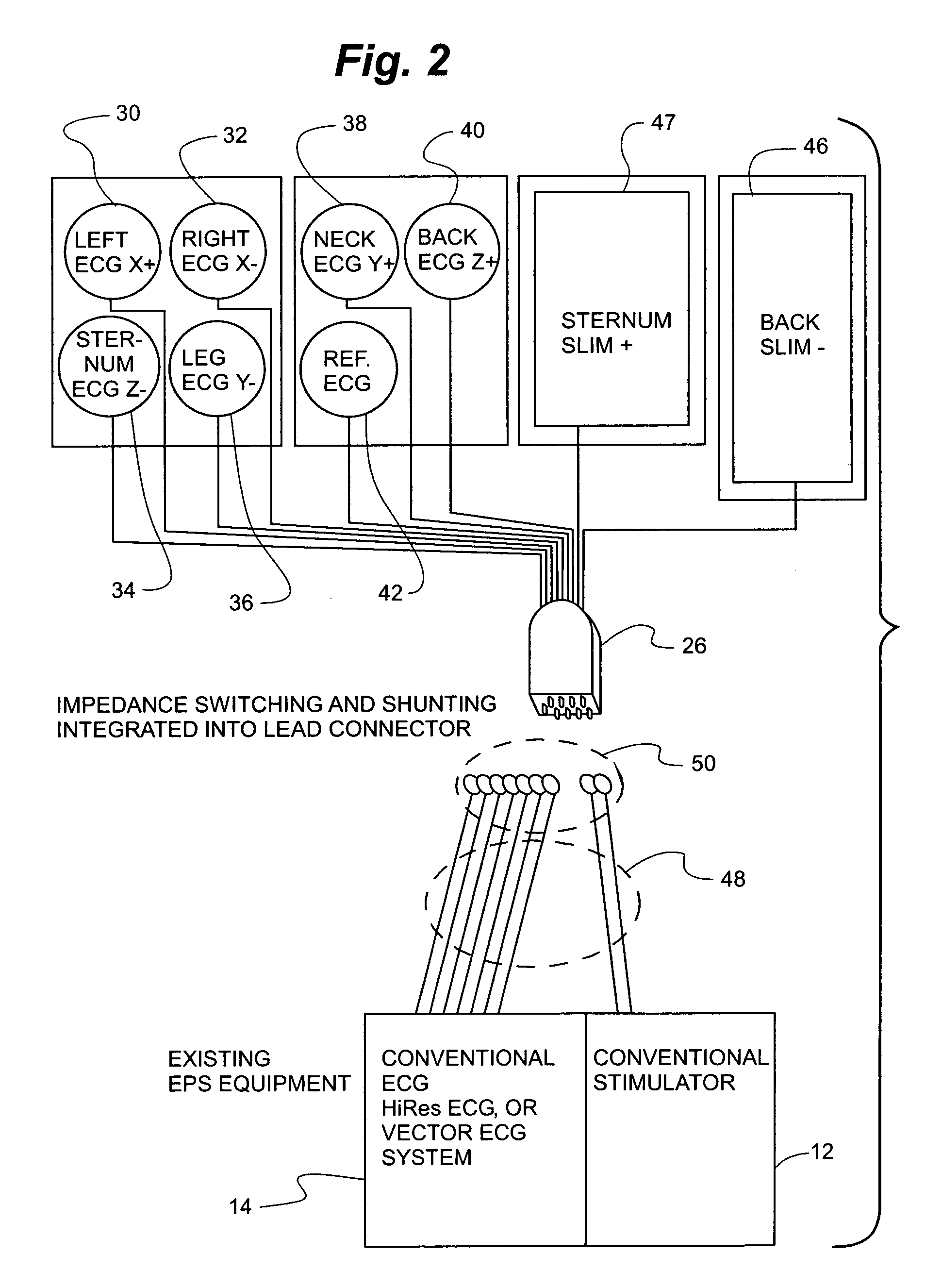 Sensing artifact reduction for cardiac diagnostic system