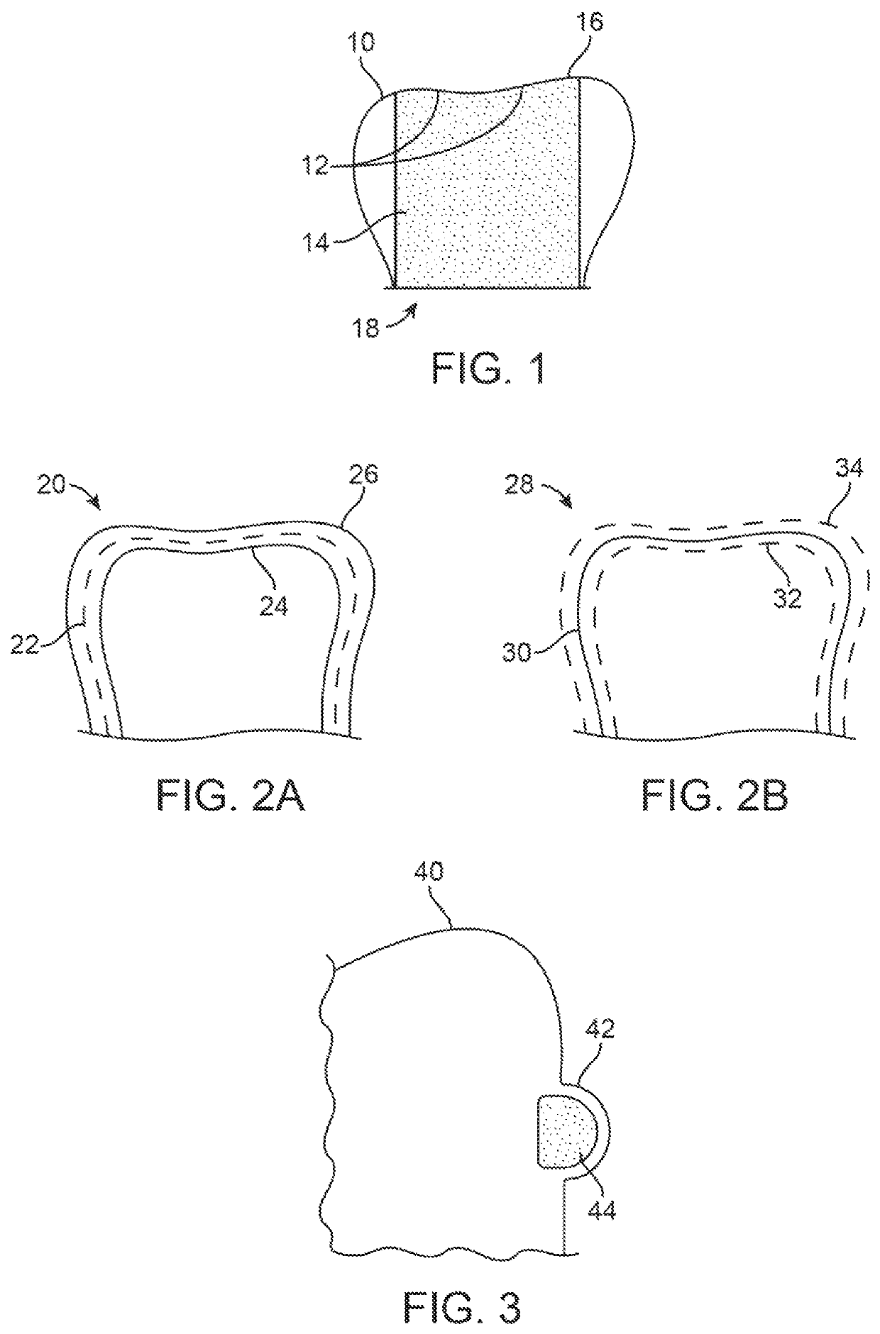 Three-dimensional printed dental appliances using support structures