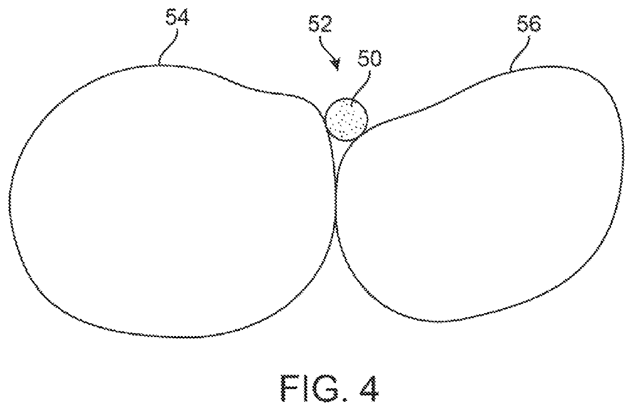 Three-dimensional printed dental appliances using support structures