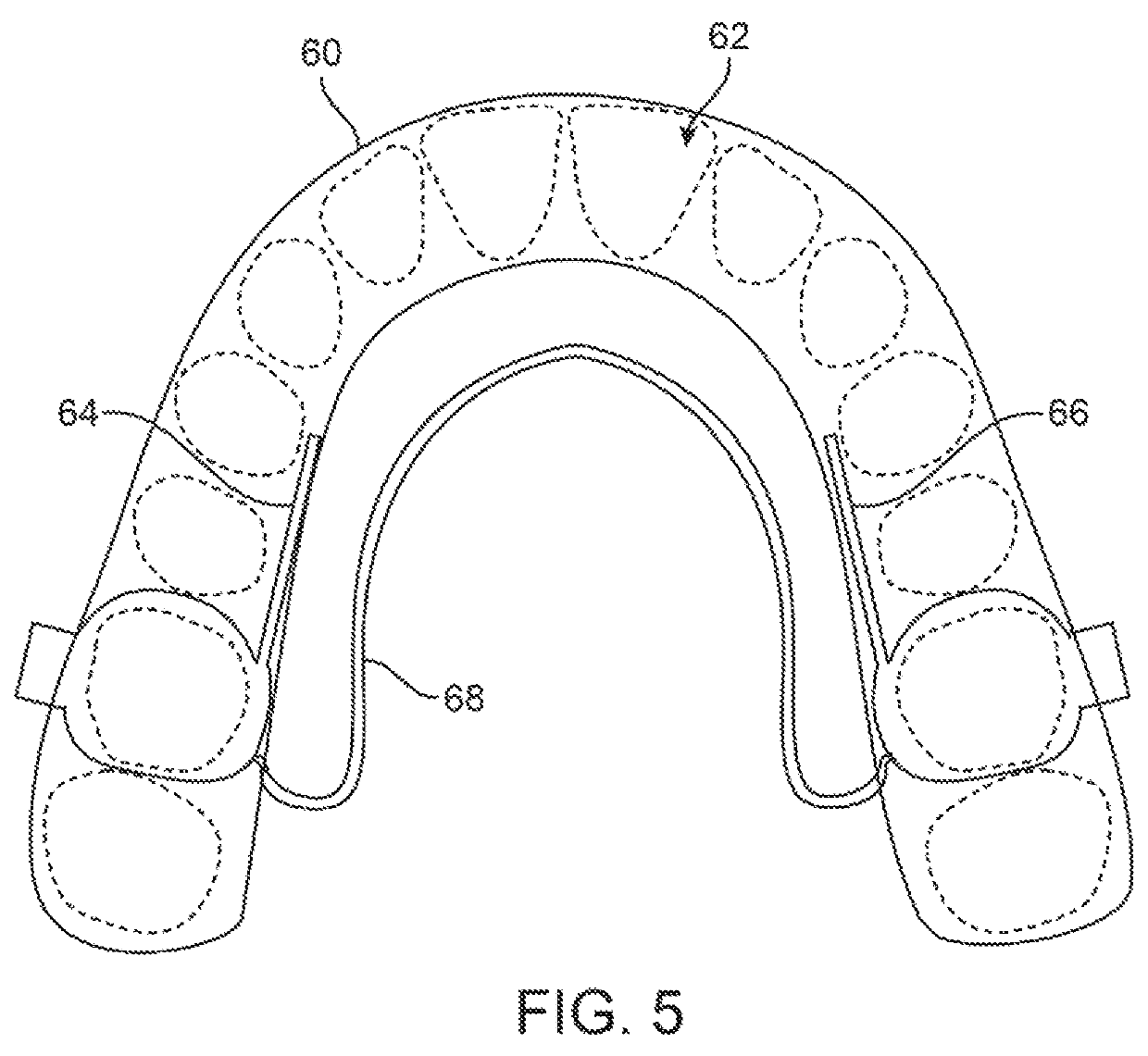 Three-dimensional printed dental appliances using support structures