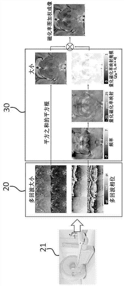 Parkinson's disease diagnosis device and method based on artifical intelligence