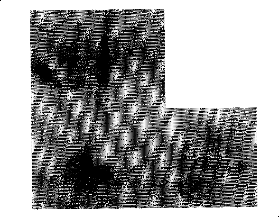 Trichoderma viride engineering bacterium and uses thereof