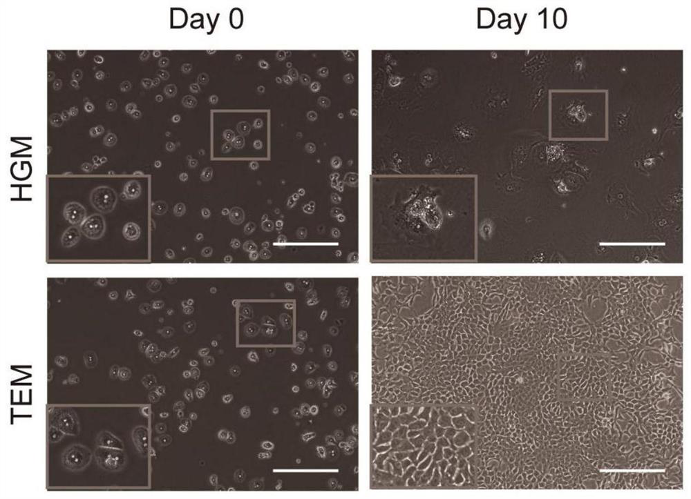 Primary hepatocyte-derived liver precursor-like cell model, preparation method and application for hepatitis B virus infection