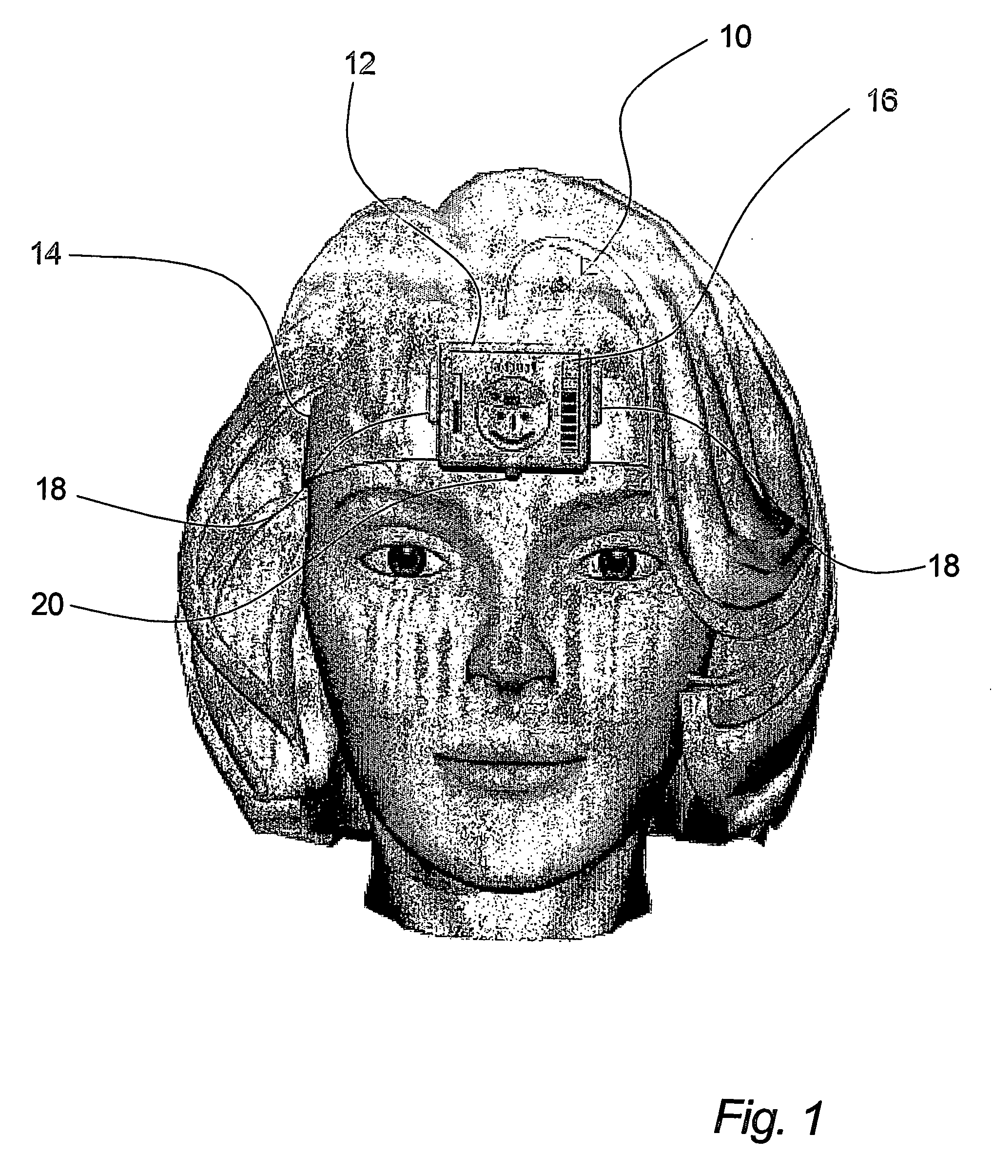 Method of and apparatus for monitoring of muscle activity