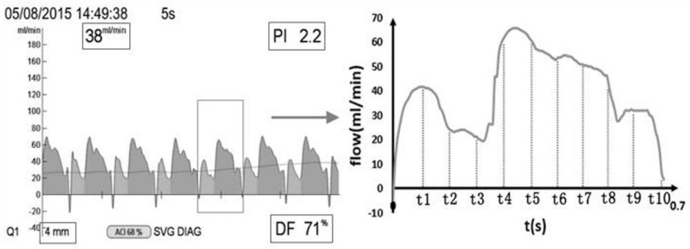 A method for predicting graft permeability model based on wall shear stress image features in heart bypass surgery