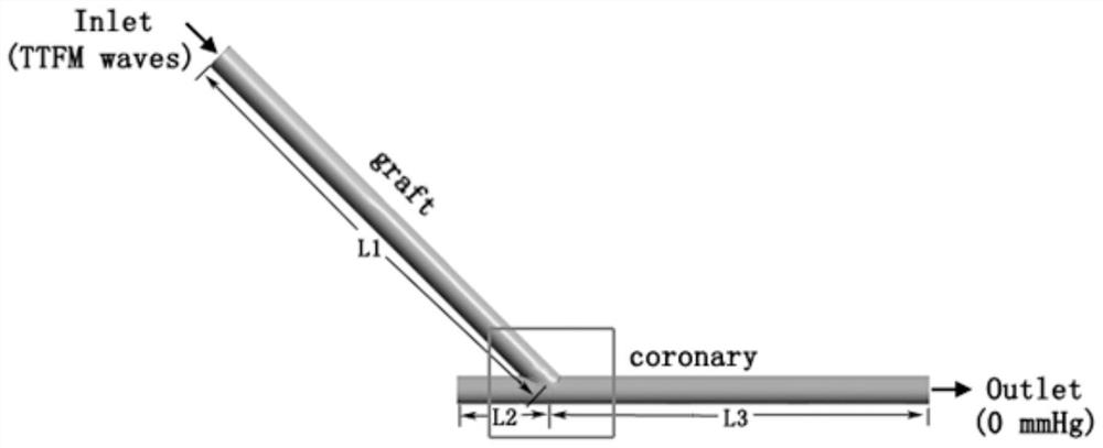 A method for predicting graft permeability model based on wall shear stress image features in heart bypass surgery