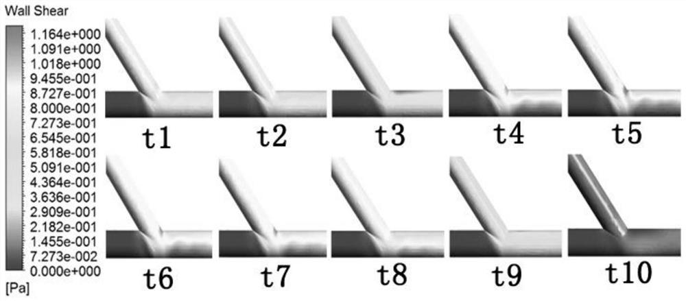 A method for predicting graft permeability model based on wall shear stress image features in heart bypass surgery