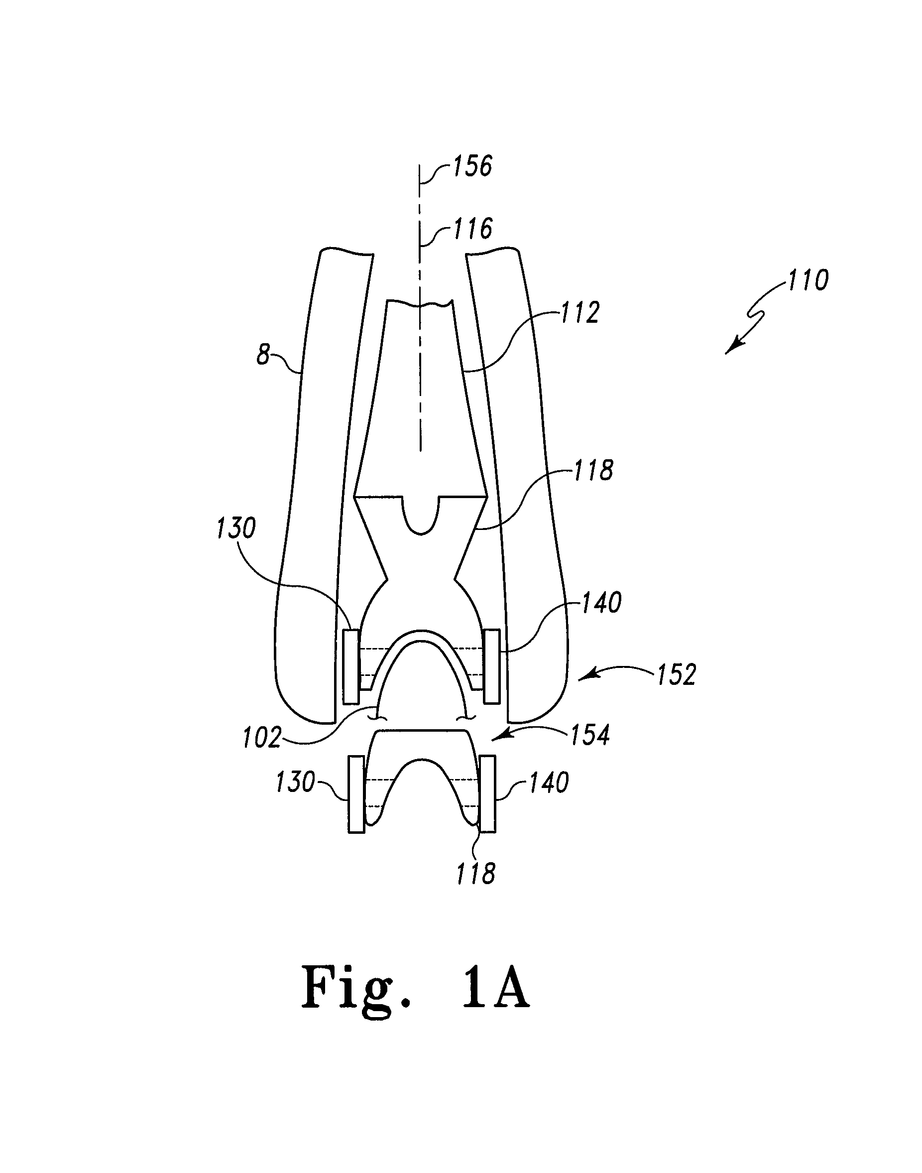 Modular total elbow prosthesis, humeral component and associated kit