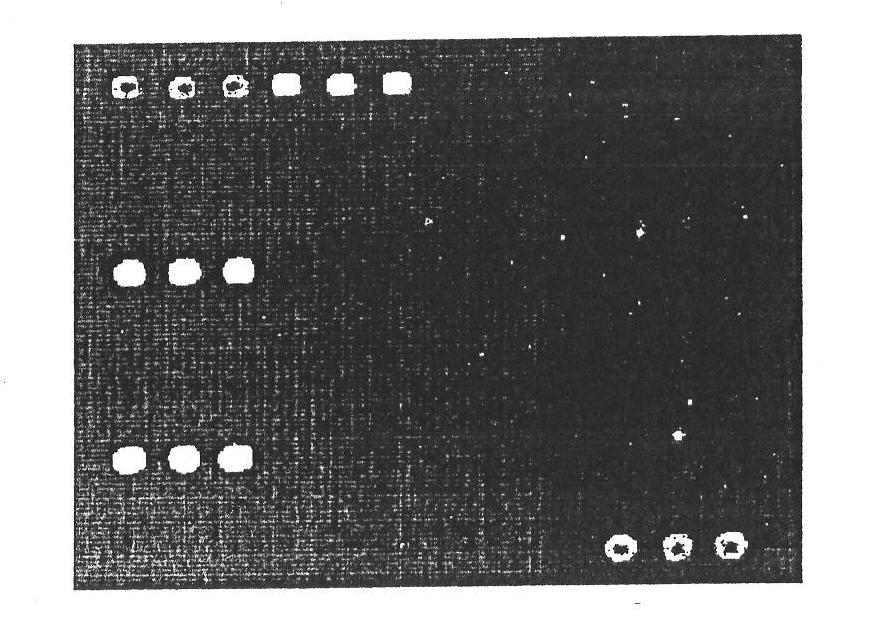 Detection genetic chip and detection kit for infectious diarrhea