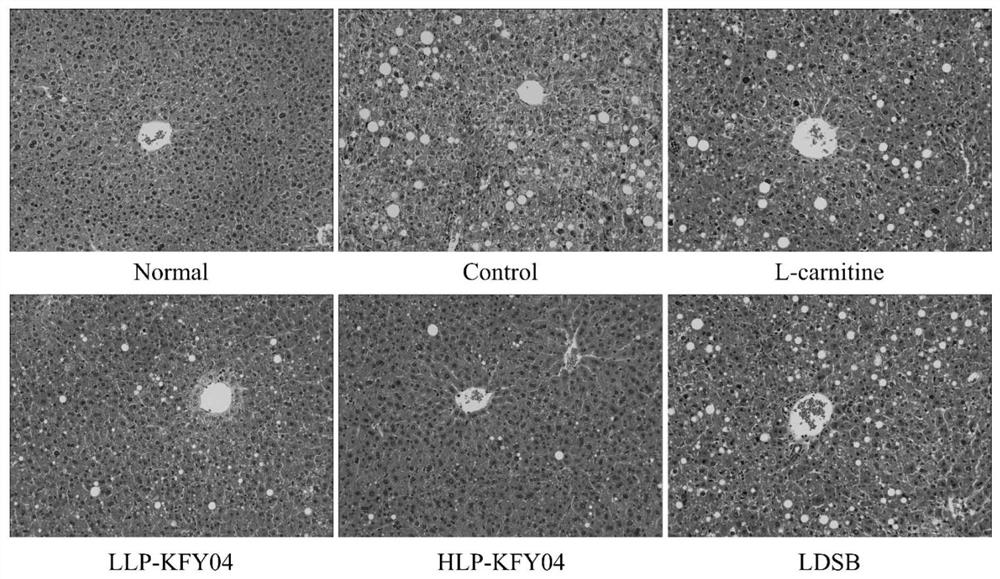 Lactobacillus plantarum with functions of losing weight and reducing lipid and application thereof