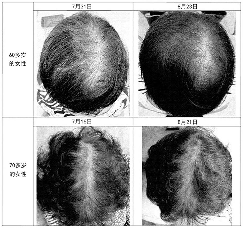 External agent for hair growth or hair loss prevention