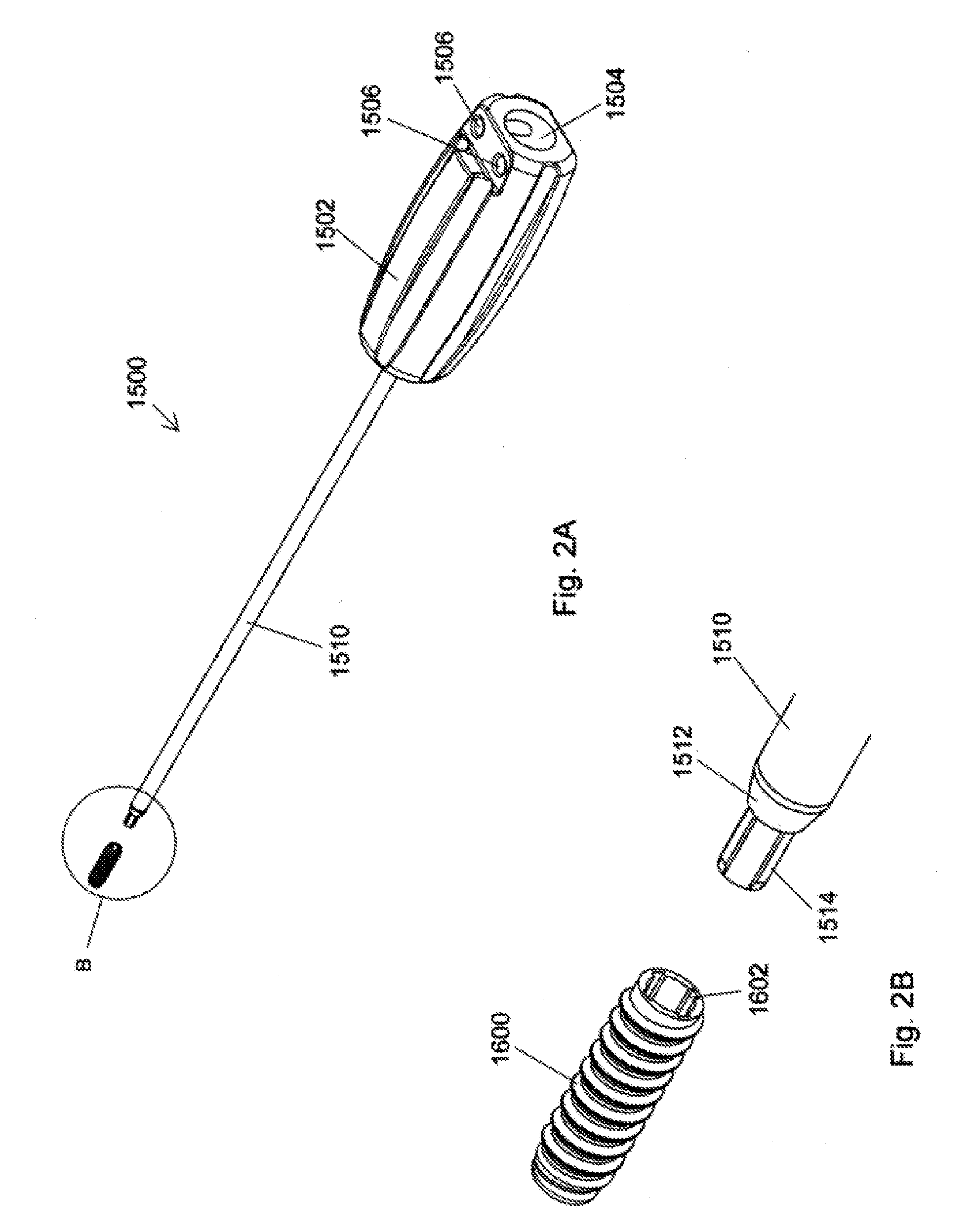 Implant placement systems, devices and methods