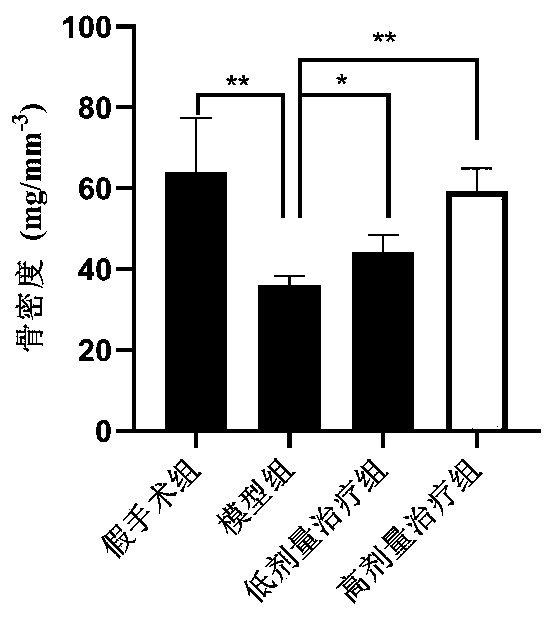 Application of punicalagin in preparing medicine for preventing and curing postmenopausal osteoporosis