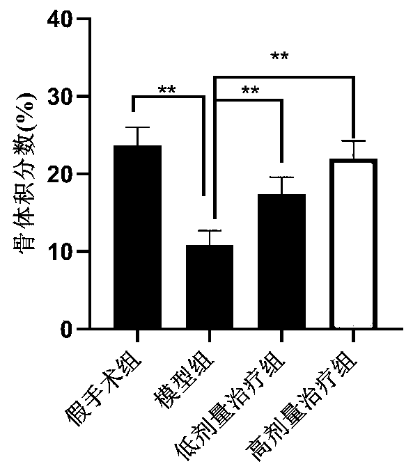 Application of punicalagin in preparing medicine for preventing and curing postmenopausal osteoporosis