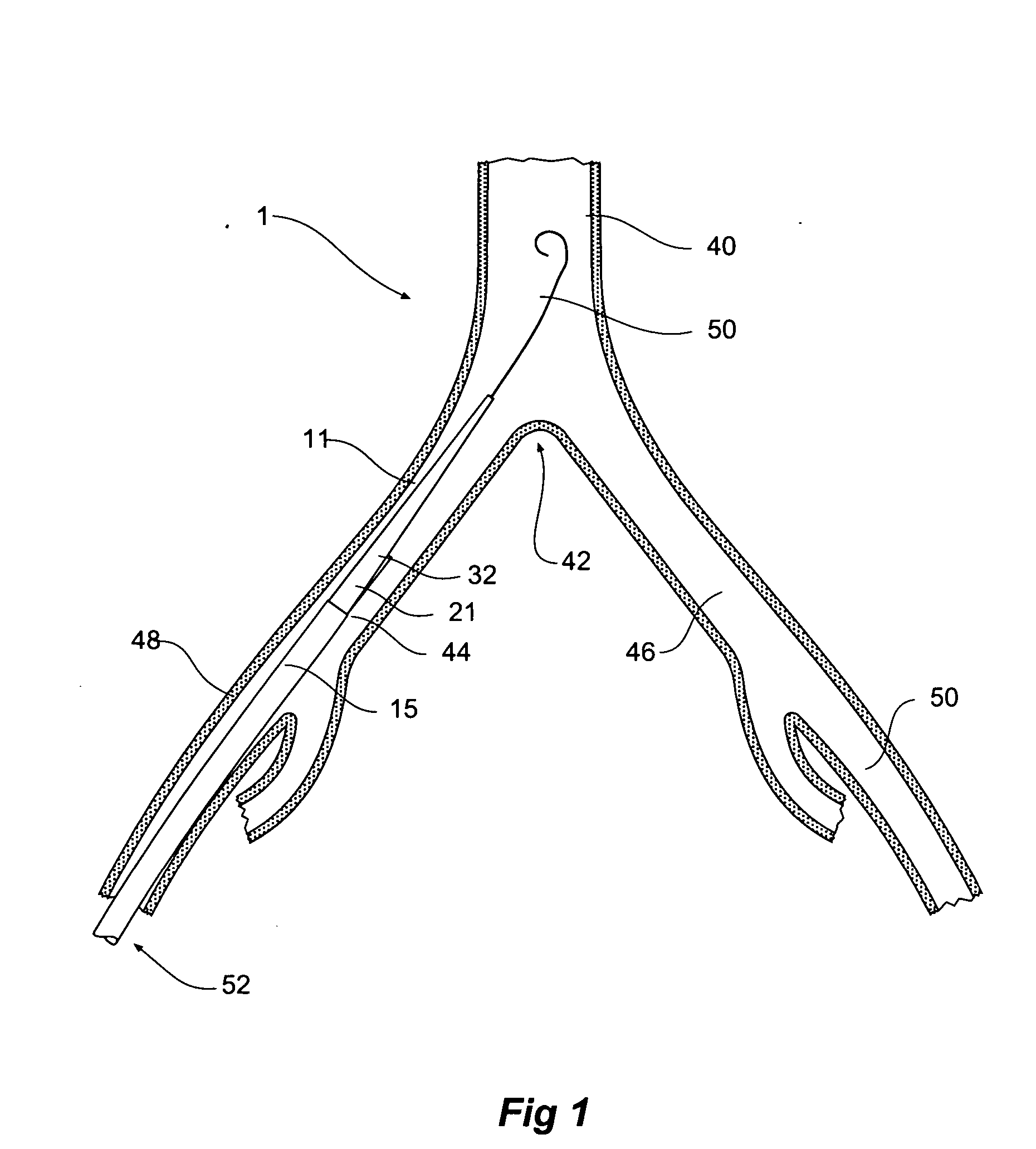 Introducer for an iliac side branch device