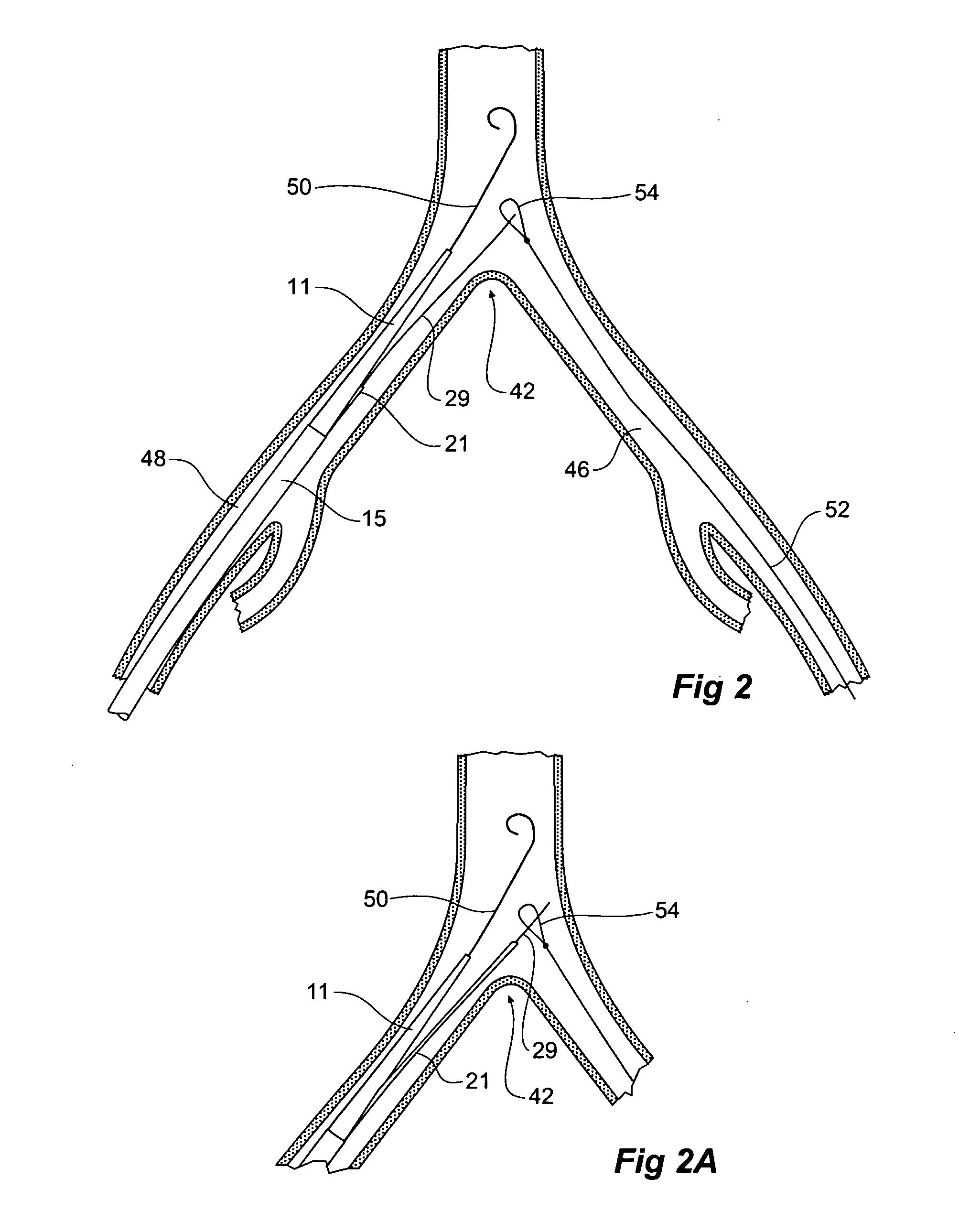 Introducer for an iliac side branch device