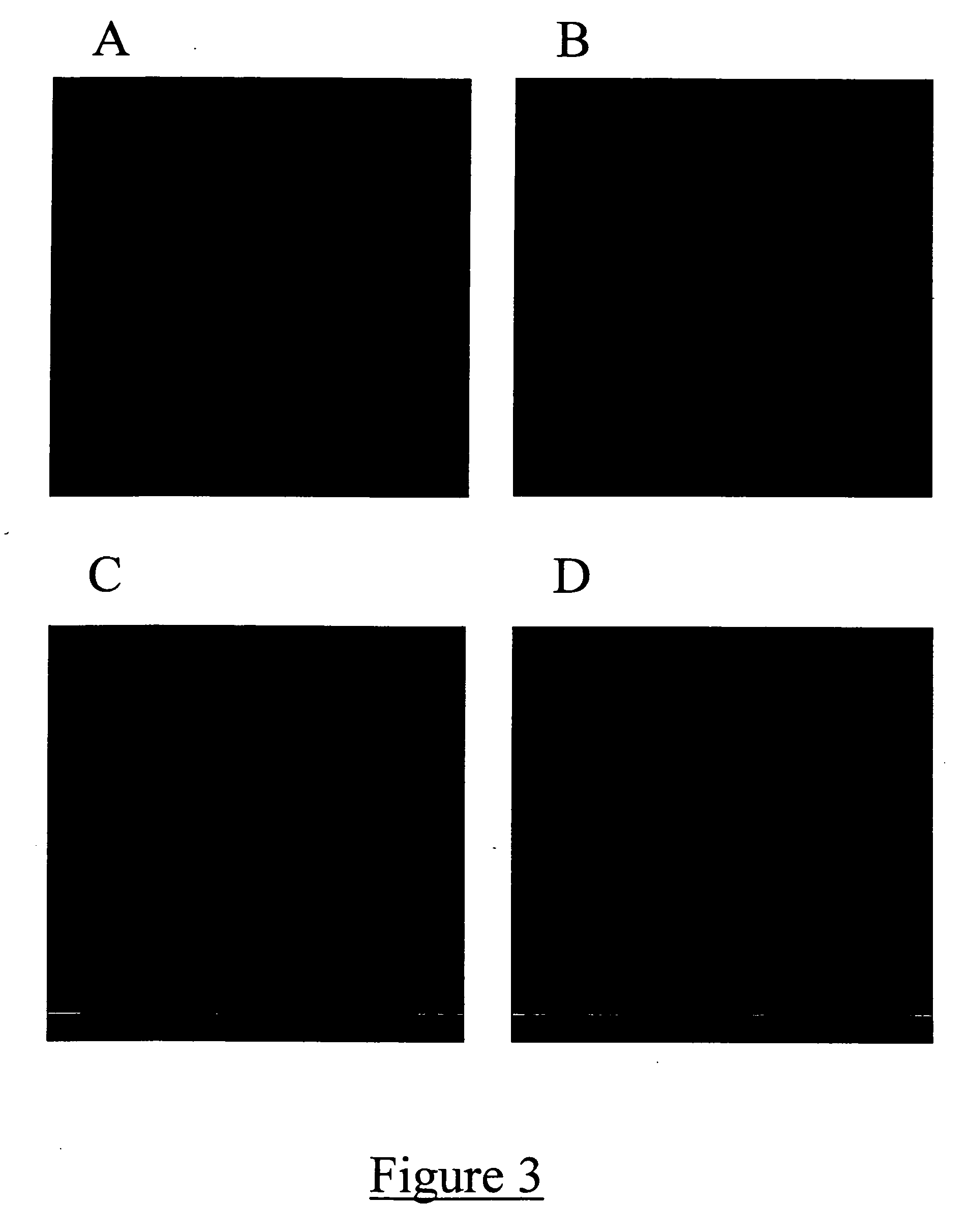 Method for treating a condition with neural progenitor cells derived from whole bone marrow