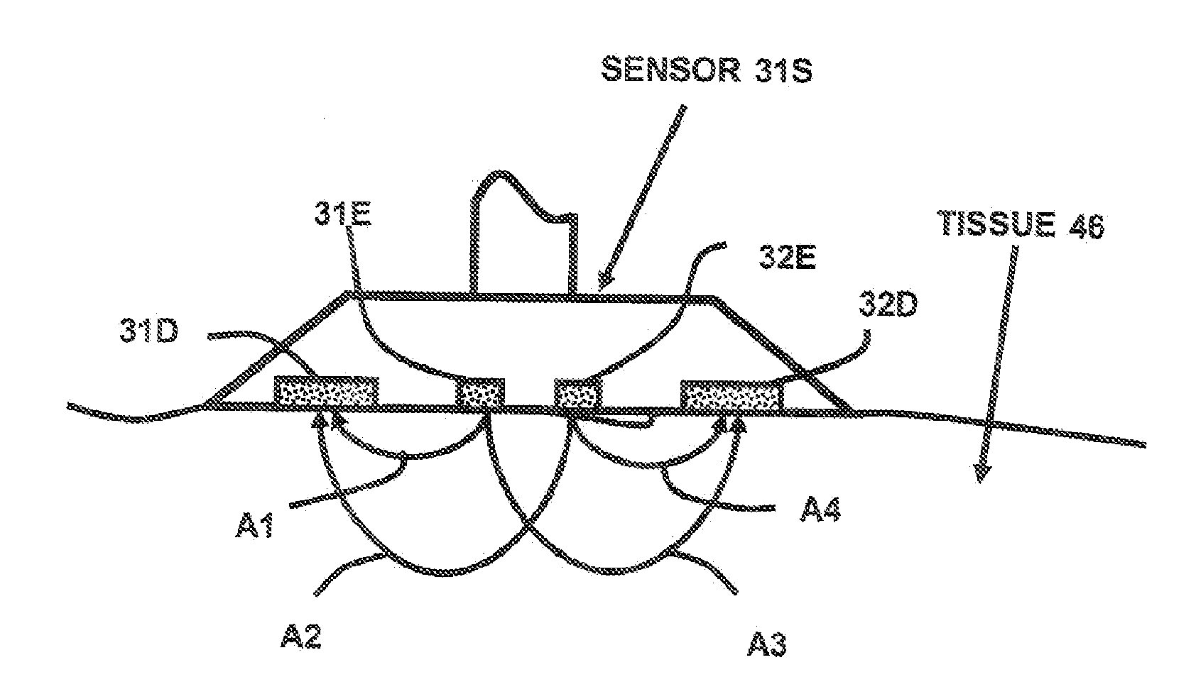 Tissue oximetry apparatus and method