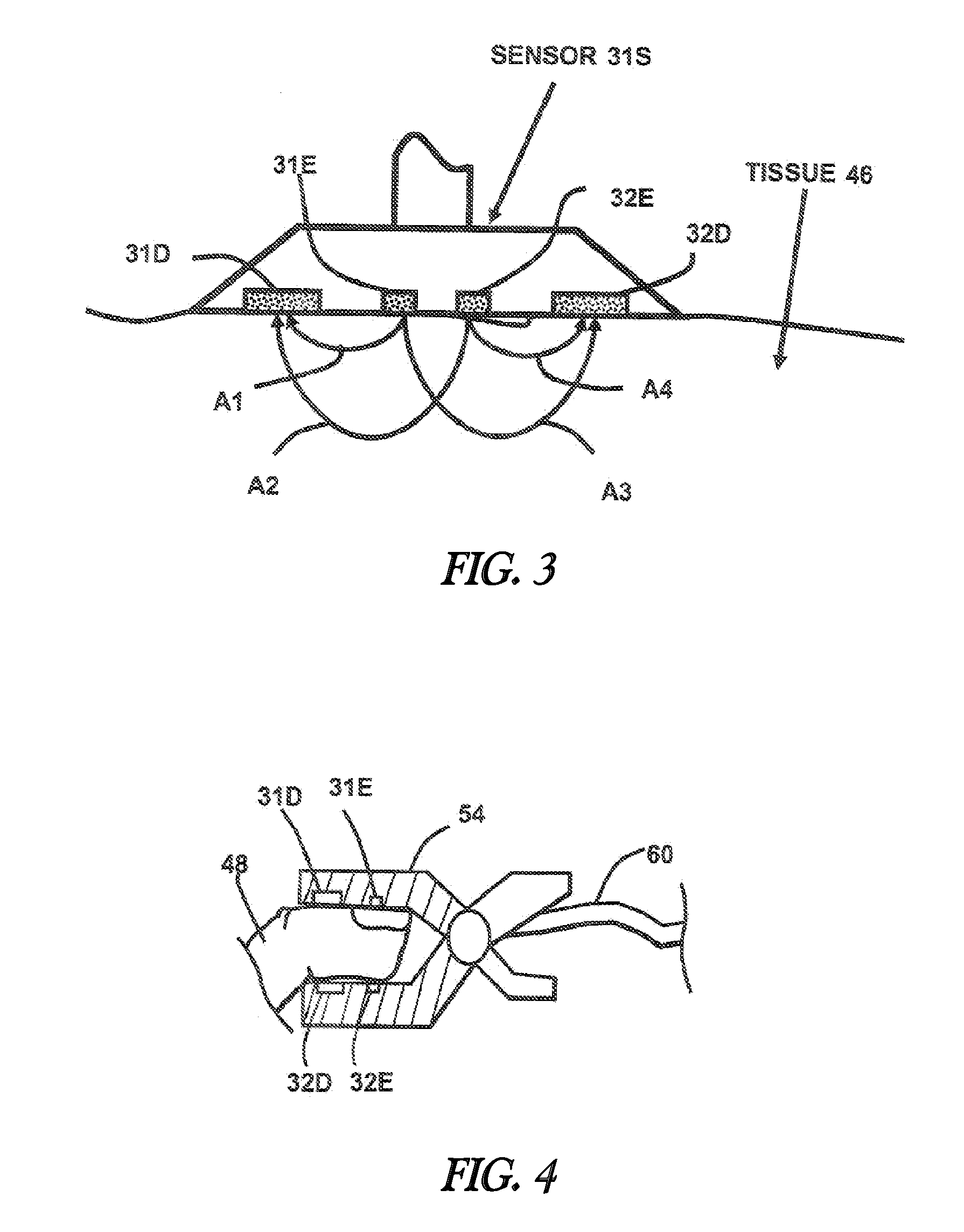 Tissue oximetry apparatus and method