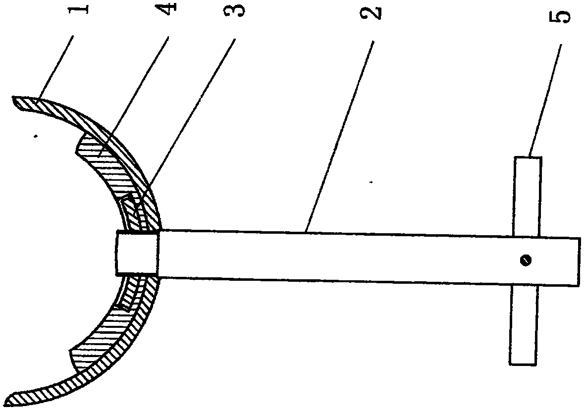 Cervical amniotic membrane support