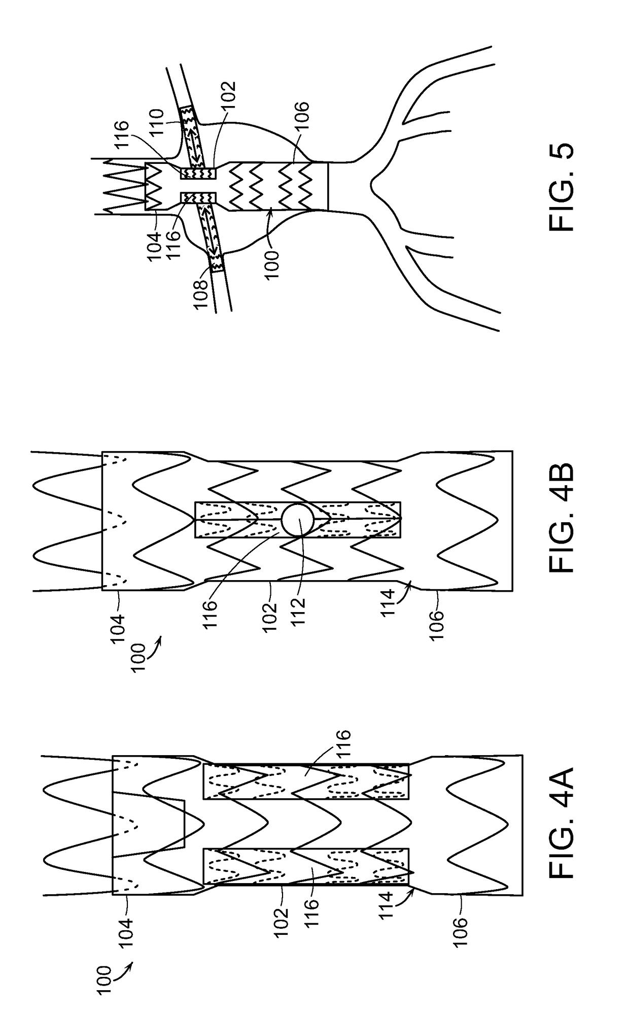 Stent graft with internal tunnels and fenestrations and methods of use