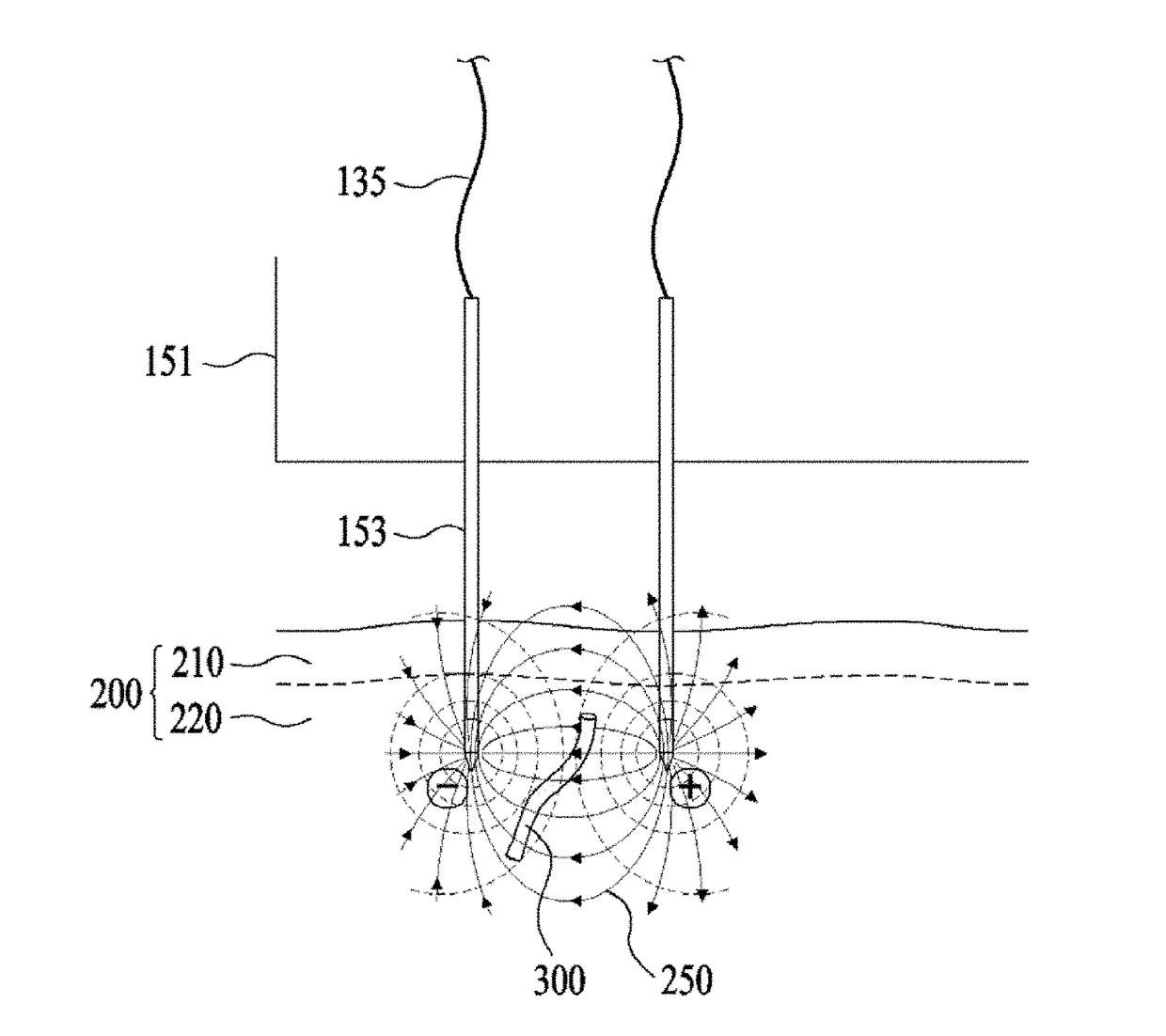 Apparatus for treating blood vessels in skin