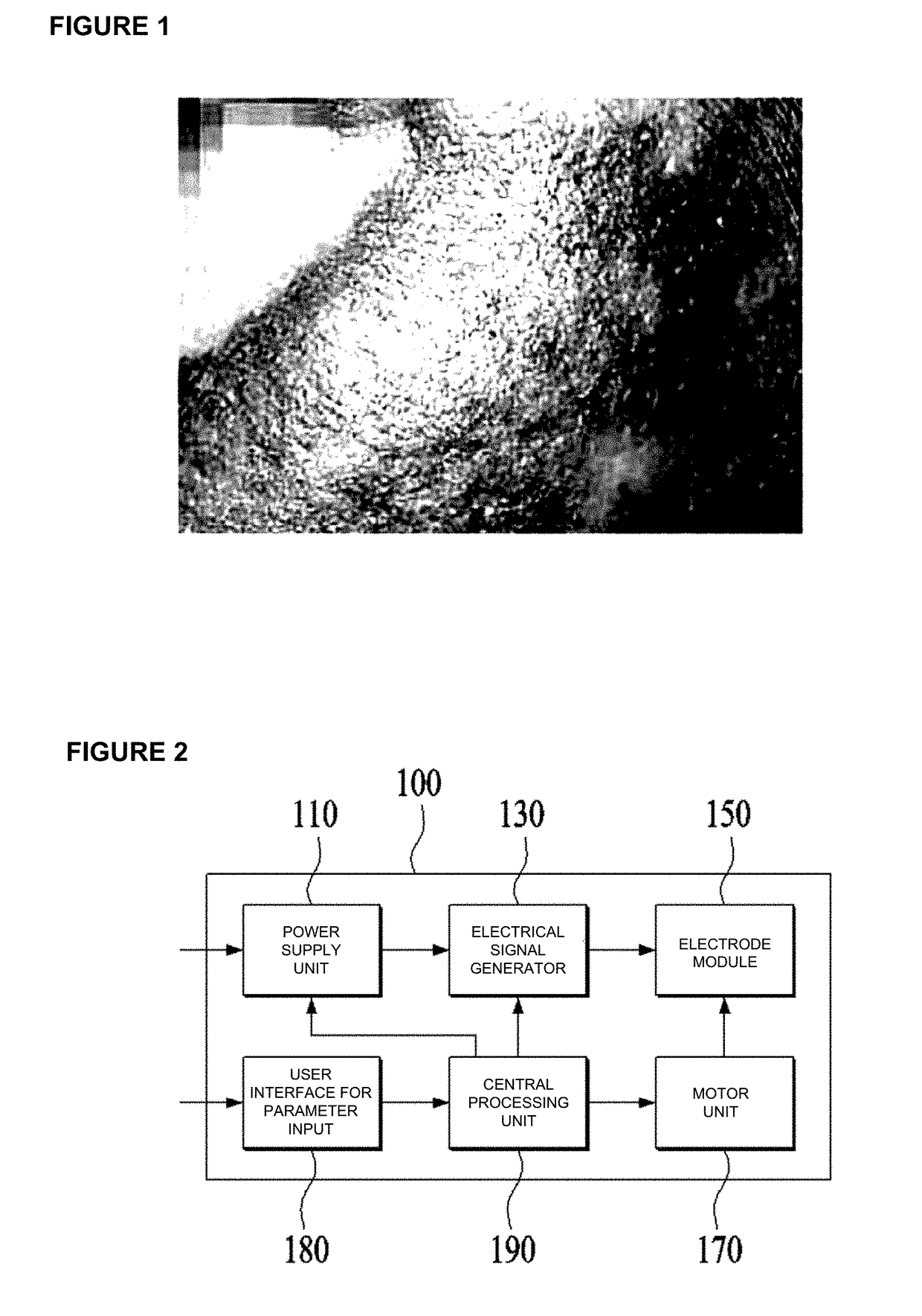 Apparatus for treating blood vessels in skin