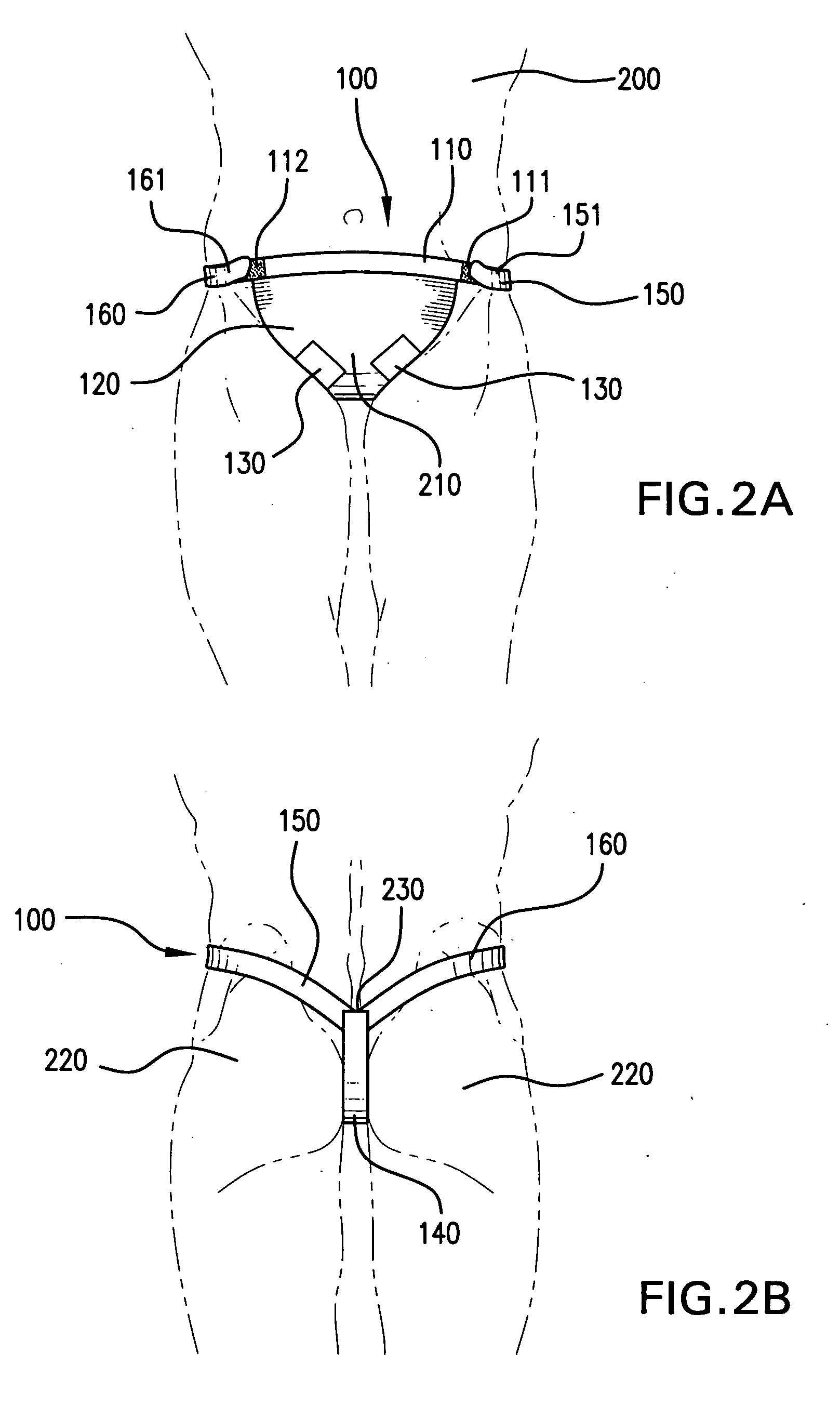 Methods & apparati for the close application of therapeutic & other devices to the pelvic area