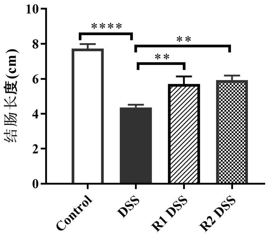 Meal replacement powder suitable for IBD inflammatory bowel disease patient to eat, and preparation method of meal replacement powder