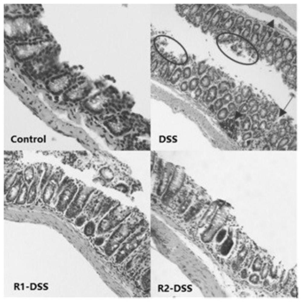 Meal replacement powder suitable for IBD inflammatory bowel disease patient to eat, and preparation method of meal replacement powder