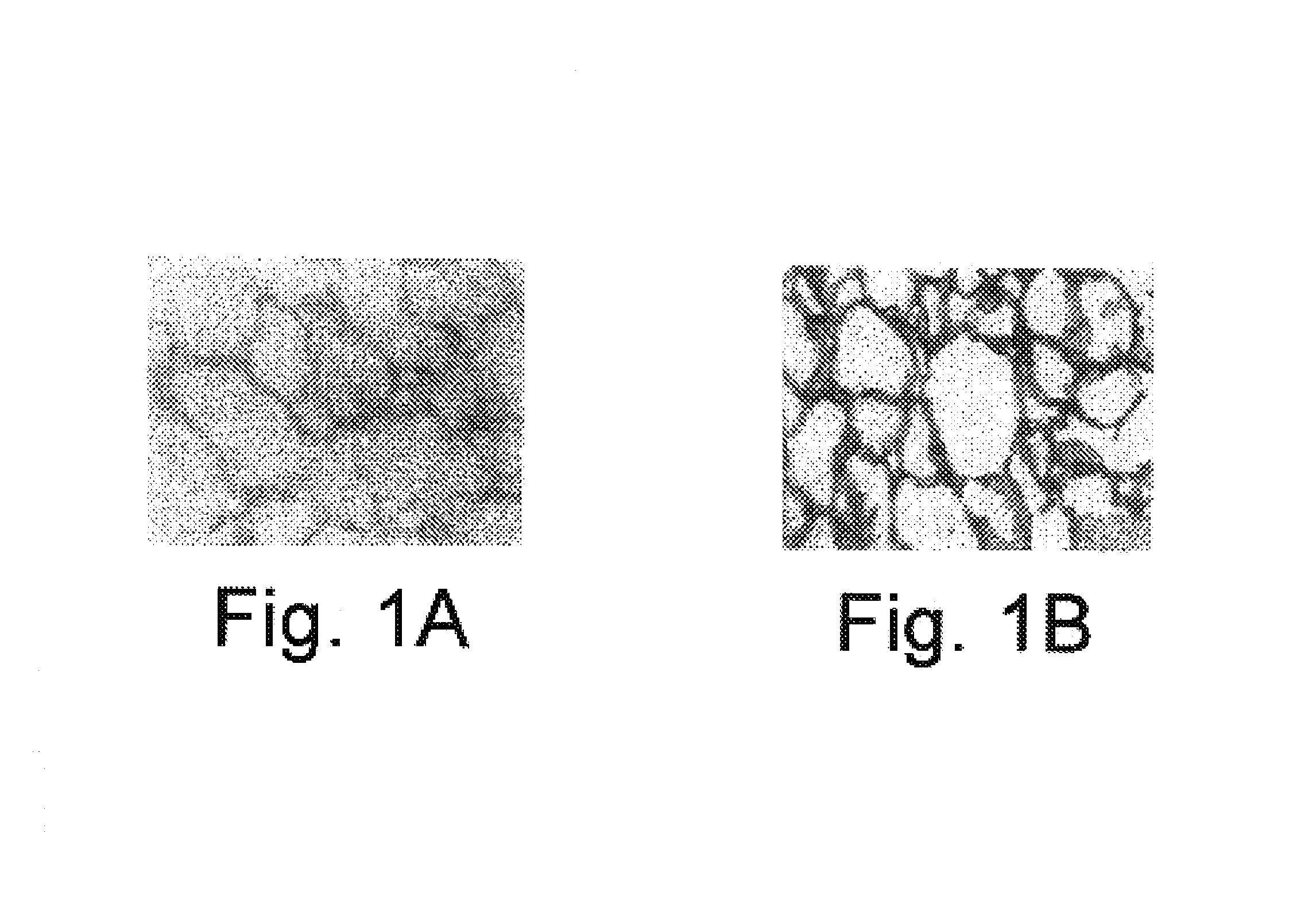 Adipocyte Insulin adpinsl with Insulin A and B chains and an effective method of treating type 2 diabetes in a subject using adipocyte insulin