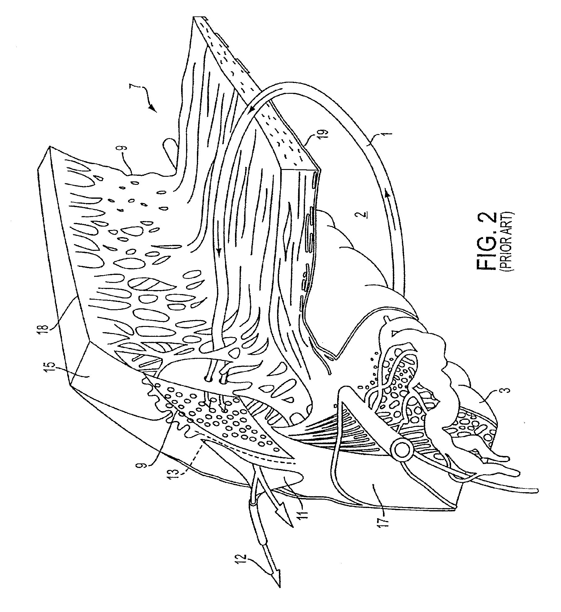 Delivery system and method of use for the eye