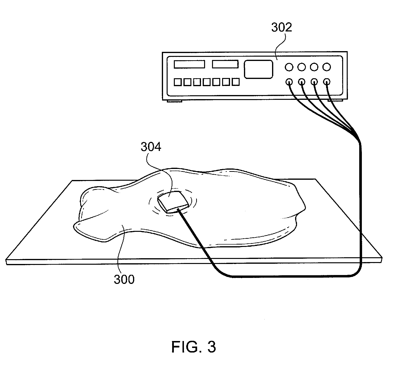 Uterine foam insert for ablation