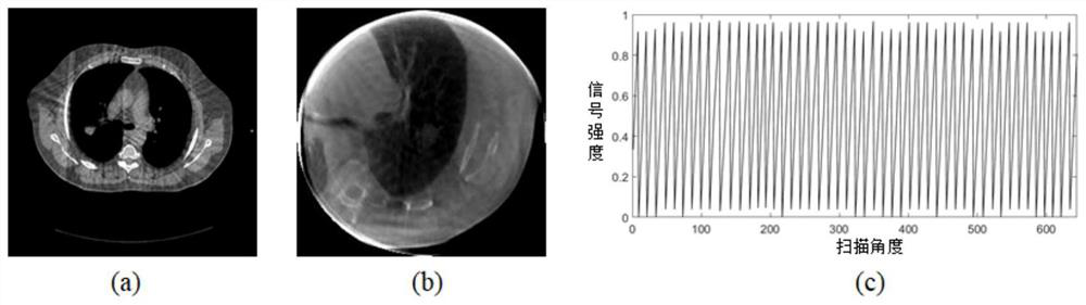 4D-CBCT reconstruction method combining motion estimation and space-time tensor enhanced representation