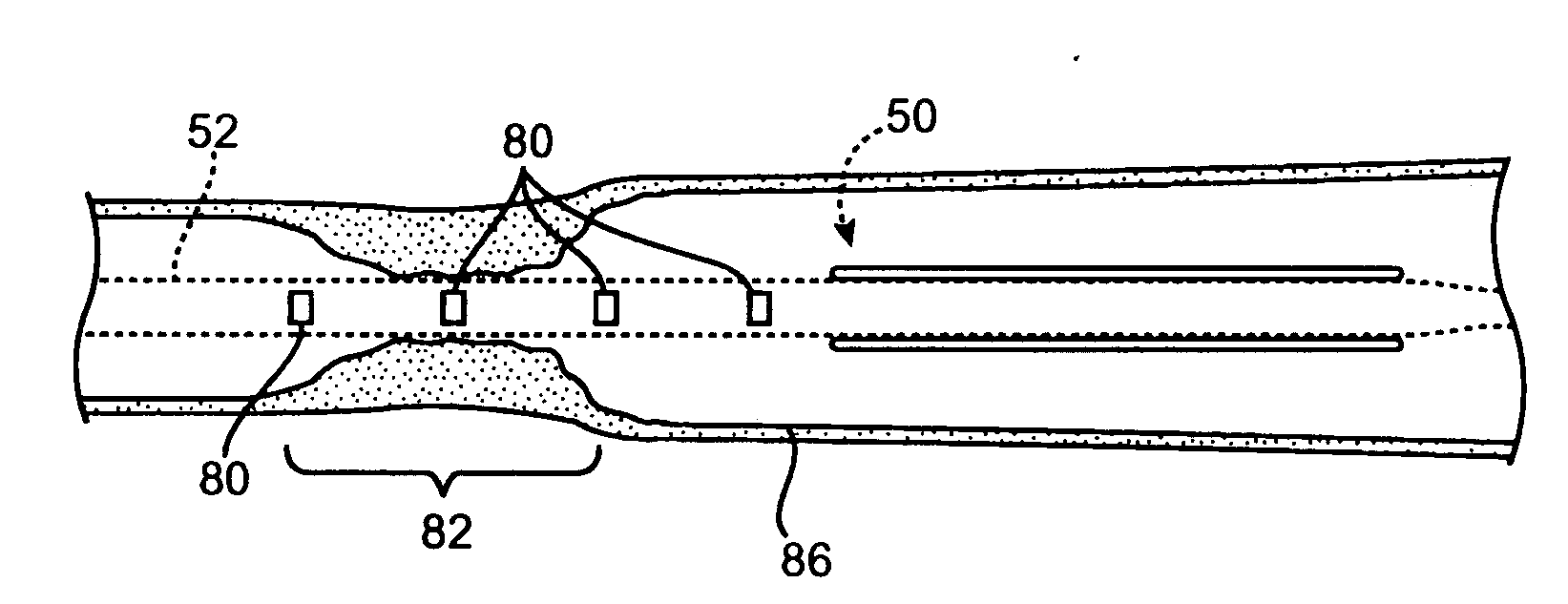 Rapid exchange stent delivery catheter